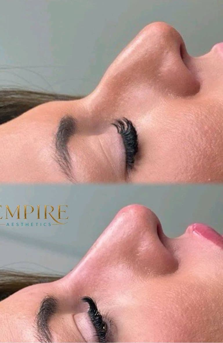 Brows and lashes before and after treatment at Empire Aesthetics