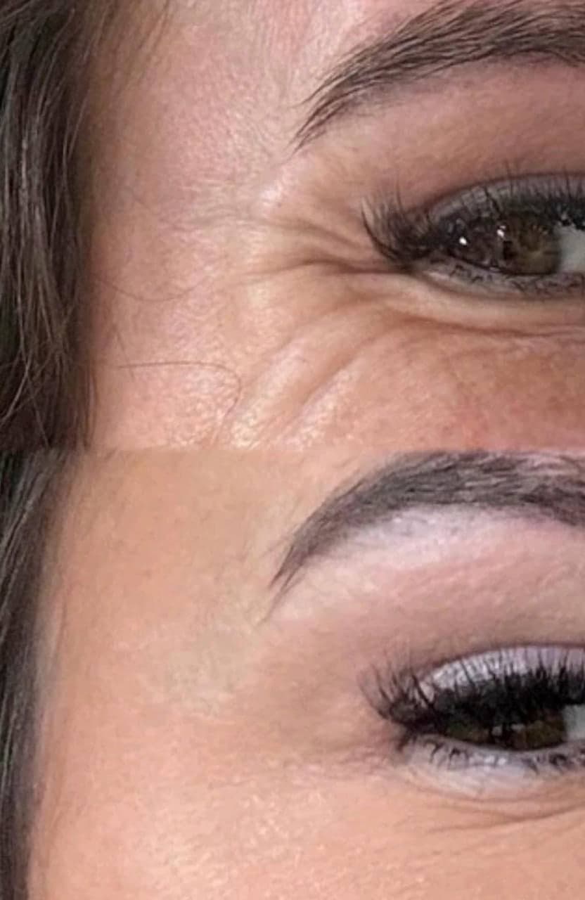 A brow and lash set before and after treatment at Empire Aesthetics